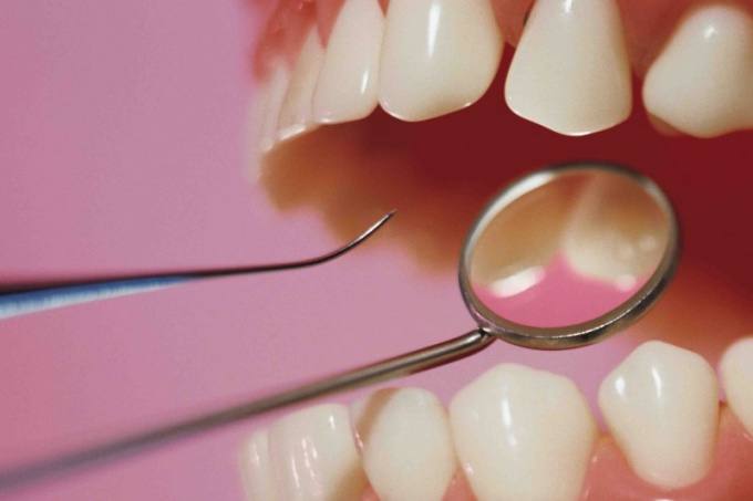 Как проводят лечение зубов в современных клиниках Дзержинска