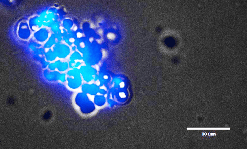 Фантастические микробы-экстремофилы из шахт Баксанской нейтринной обсерватории