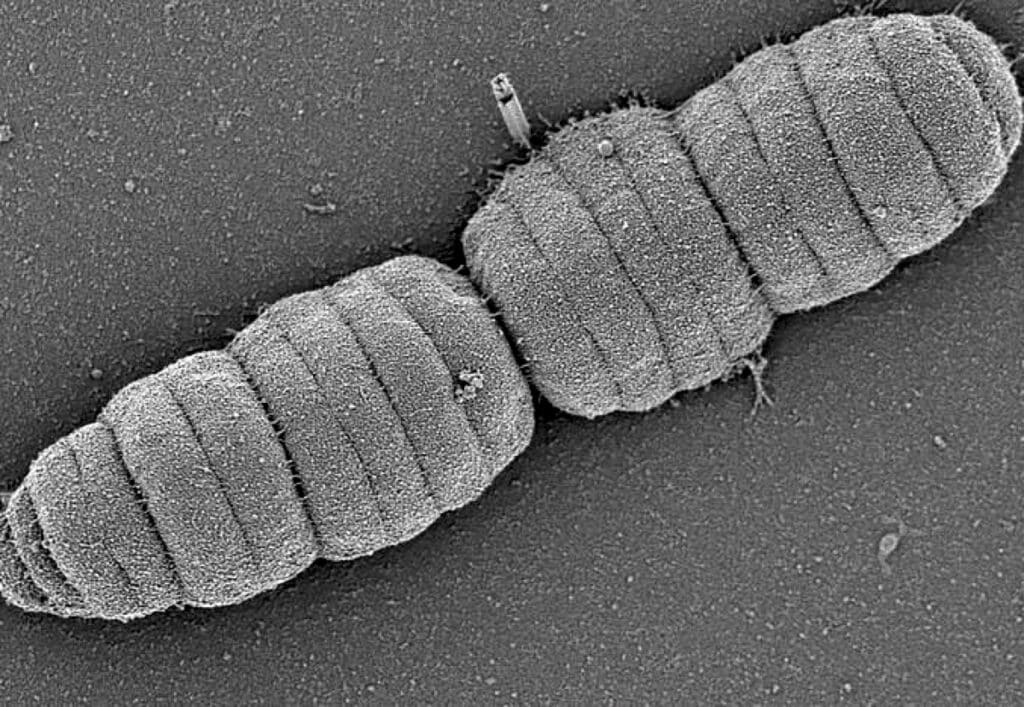 55361 Биологи нашли «гусеничную» бактерию, обитающую в ротовой полости